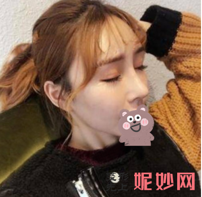 吴玉家做鼻子怎么样？
