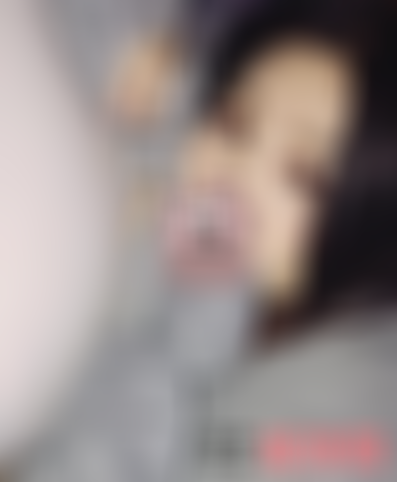 北京金燕子医疗美容口碑如何？