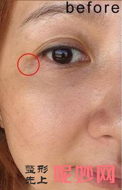 北京圣爱整形美容医院正规吗？