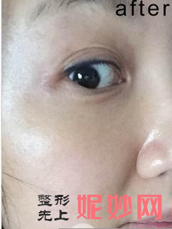 北京圣爱整形美容医院正规吗？