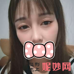 曾高做鼻子怎么样？