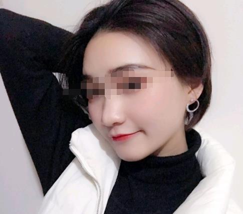磨骨手术多少钱一次，磨骨手术费介绍
