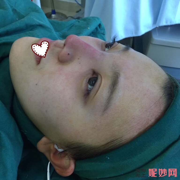 东莞美熙伊美医院正规吗？医生介绍+鼻综合案例分享+价格表
