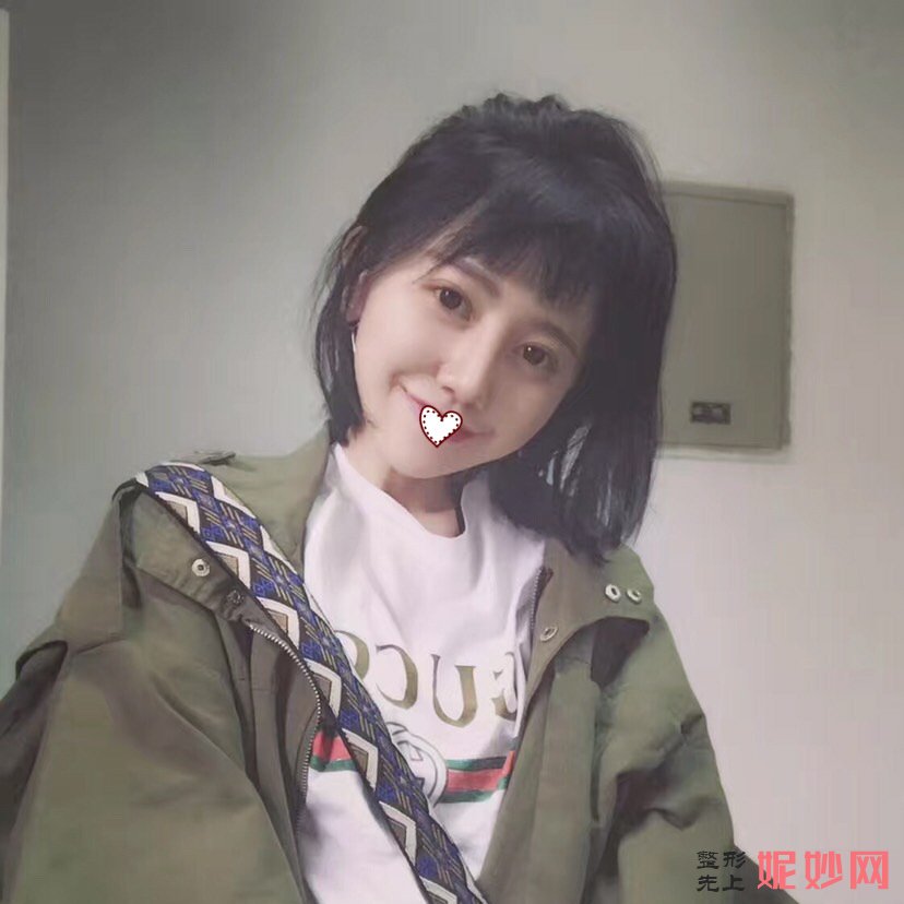 东莞美熙伊美医院正规吗？医生介绍+鼻综合案例分享+价格表