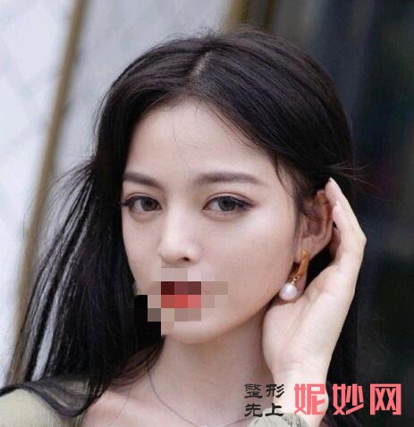 西京金长鑫双眼皮做的咋样？医生介绍，双眼皮案例有分享，价格表