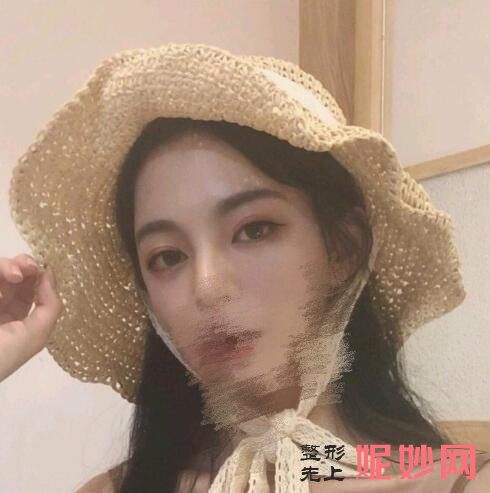 西京金长鑫双眼皮做的咋样？医生介绍，双眼皮案例有分享，价格表