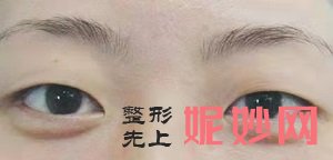 南京医科友谊整形医院技术怎么样?西京医院医生真人案例效果_收费价目表？