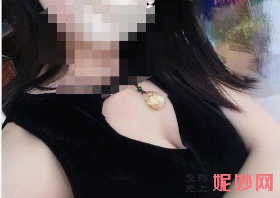 武汉中翰自体脂肪丰胸怎么样,安全吗？附案例分析及价格表！