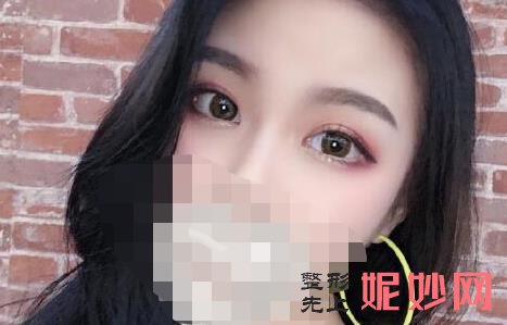 济南双眼皮哪家医院好？海峡美容医院闫迎军怎么样，附案例分析及价格表！