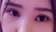 北京韩啸白永辉修复双眼皮怎么样？附案例分析和价格表