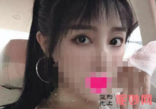 上海九院双眼皮修复较好的专家有哪些？附案例分享和价格表！