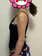 成都艺星医疗美容医院医生技术如何？附案例分析和价格表