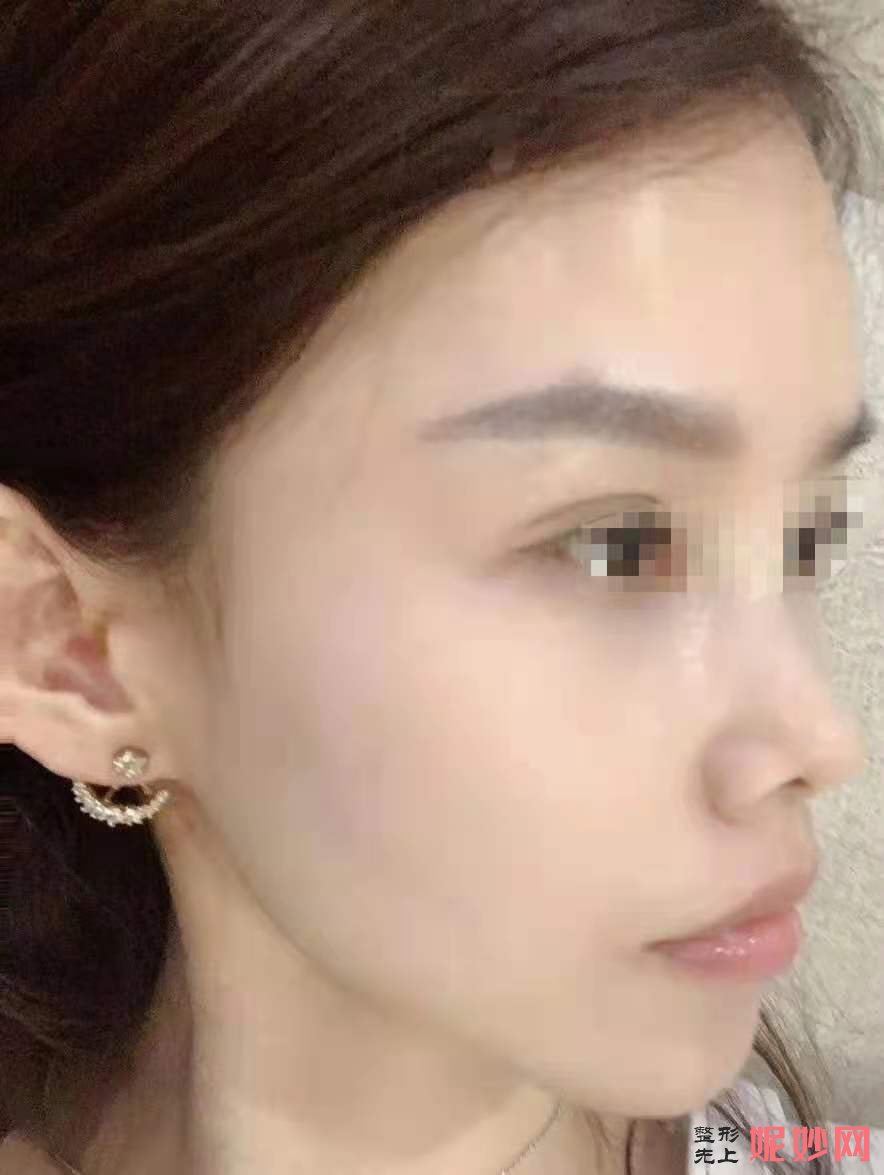 成都圣丹福整形美容医院怎么样？附案例分析和价格表