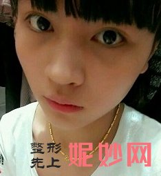 成都美绽美整形美容医院怎么样？附案例分析和价格表