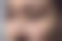 上海愉悦美联臣医疗美容医院技术怎么样？附案例分析和价格表