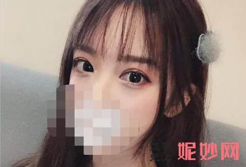 深圳米兰柏羽高新医院做双眼皮怎么样？附案例分享和价格表！