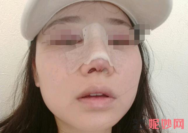 成都铜雀台医学美容医院正规吗？能做隆鼻吗？附案例和价格表！