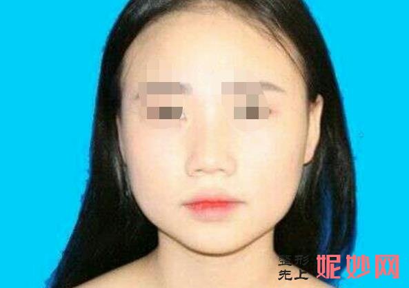 成都铜雀台医学美容医院正规吗？能做隆鼻吗？附案例和价格表！