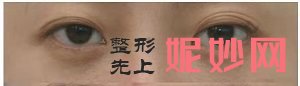 昆明艺星医疗美容医院怎么样？内含价格表及案例分析