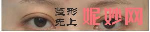 昆明艺星医疗美容医院怎么样？内含价格表及案例分析