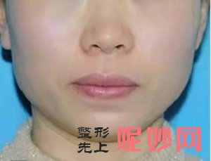 南宁悦美韩星整形怎么样？内含价格表及案例分析