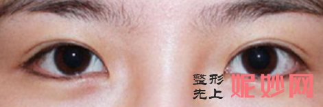 杭州甄美医疗美容医院怎么样？内附案例及价格表