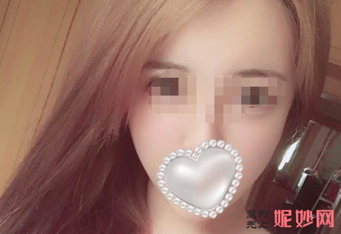 重庆曹阳丽格医院好不好？能做面部提拉吗？医院介绍附案例和价格表！