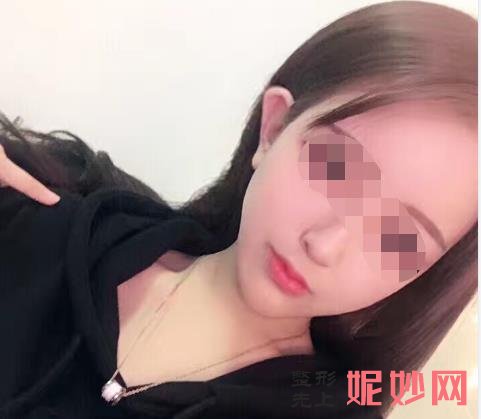 重庆曹阳丽格医院好不好？能做面部提拉吗？医院介绍附案例和价格表！