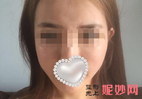 重庆曹阳丽格医院好不好？能做面部提拉吗？医院介绍附案例和价格表！