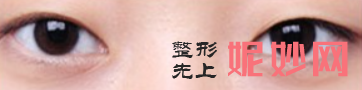 长沙贝美医疗美容医院怎么样？内附案例及价格表