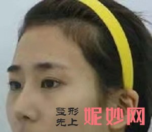 北京东方和谐冯庆亮和王自谦哪个医生好？