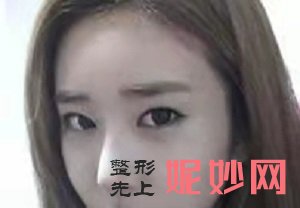 北京东方和谐冯庆亮和王自谦哪个医生好？