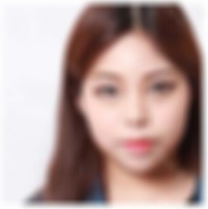 北京东方瑞丽医疗美容门诊部怎么样?附隆鼻术后恢复效果图+价格表