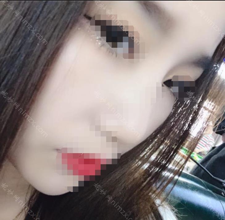 上海九院刘滢医生怎么样？个人介绍+除皱案例图分享