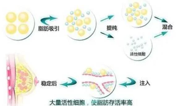 上海九院张路割眼袋怎么样？医生的成就+去眼袋案例对比图