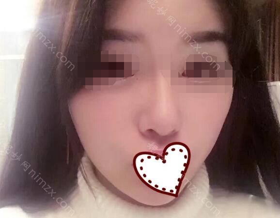 上海九院祝联隆鼻怎么样？价格多少钱？戳进来看看吧