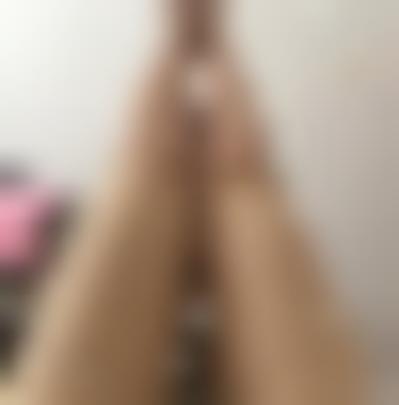 郑州辰星医疗美容医院在业界的声誉好吗？大腿吸脂前后差别明显吗？有价格表