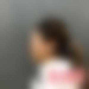 「成都美绽美整形美容医院」怎么样?正规吗|案例|价格表