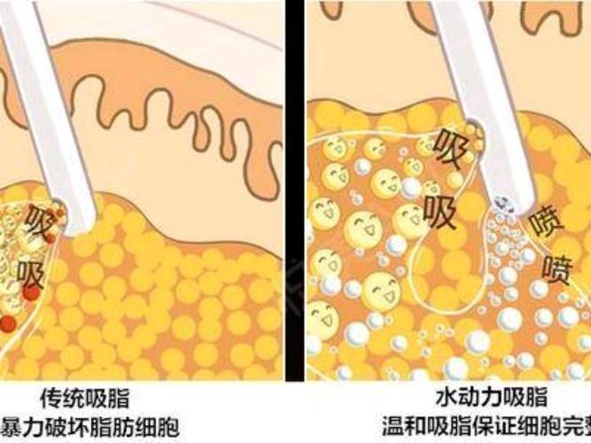 「西安美好整形美容医院周安」怎么样?擅长|案例|价格表