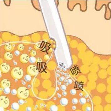 舒畅
