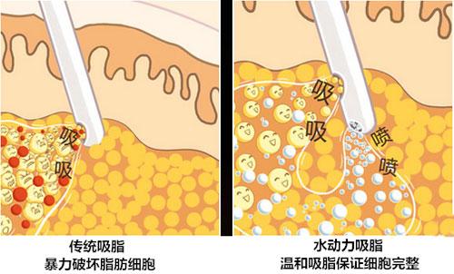 「唐山煤医整形美容院刘泽华」怎么样?擅长|案例|价格表