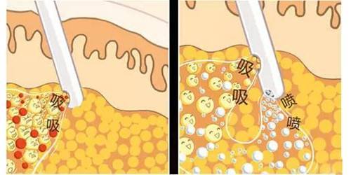 马文超
