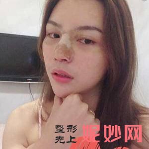 上海伊莱美医疗美容医院是正规的吗?