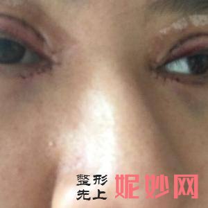 北京新星靓京广美容整形医院怎么样?