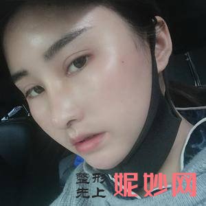 保定华美医疗整形美容医院是私立医院吗？附2021较新整形案例