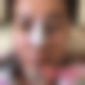 「重庆华美整形美容医院谷琪」怎么样?擅长|案例|价格表