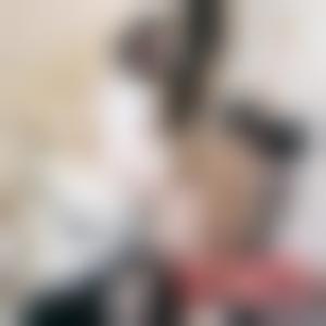 「东莞东城华美医疗美容门诊部詹慧」怎么样?擅长|案例|价格表