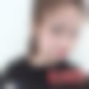 「郑州芳艺医疗美容医院杨静」怎么样?擅长|案例|价格表