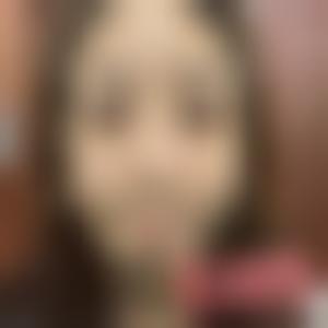 「南京医科大学第二附属医院整形美容中心沈干」怎么样?擅长|案例|价格表