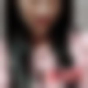 「成都艺星医疗美容整形医院谢雯」怎么样?擅长|案例|价格表